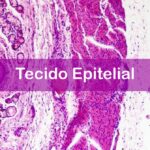 Questões sobre Tecido Epitelial